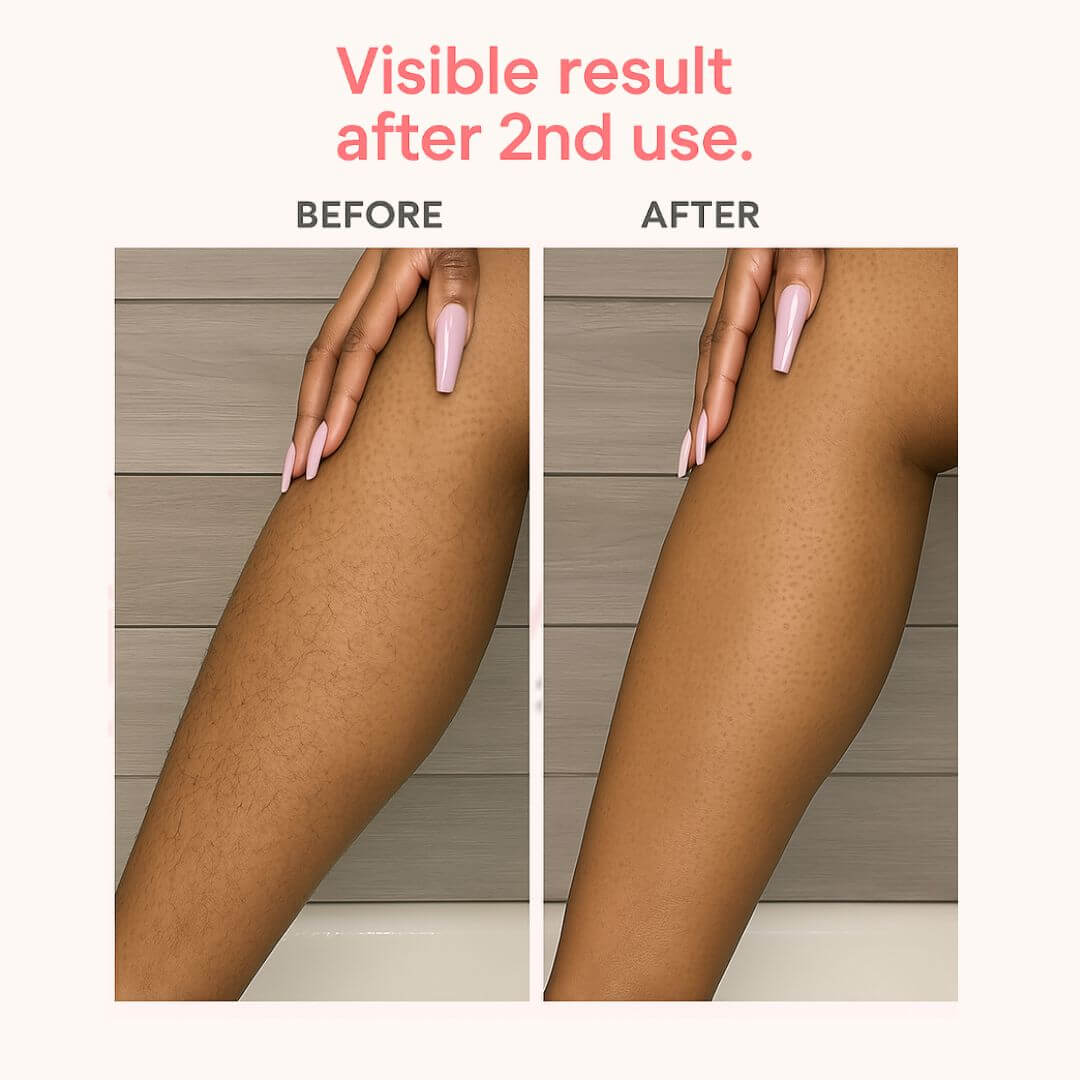 91GSkin E9000 IPL – Skin Comfort, Clinically Tested, Fast Visible Results For Face Bikini